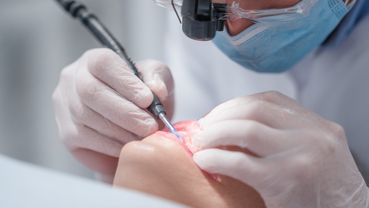 Close-up of laser dental treatment on gums by dentist in protective gear, highlighting precise, minimally invasive modern dental procedure.